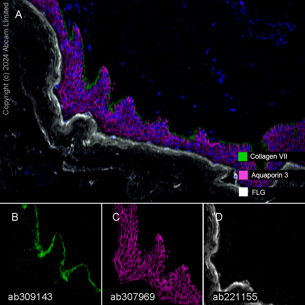 Multiplex immunohistochemistry - Anti-Filaggrin antibody [EPR21892] - BSA and Azide free (AB231821)