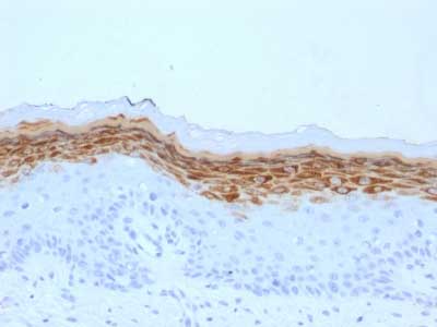 Immunohistochemistry (Formalin/PFA-fixed paraffin-embedded sections) - Anti-Filaggrin antibody [FLG/1561] (AB218395)