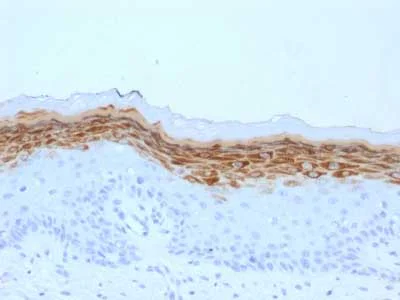 Immunohistochemistry (Formalin/PFA-fixed paraffin-embedded sections) - Anti-Filaggrin antibody [FLG/1561] (AB218395)