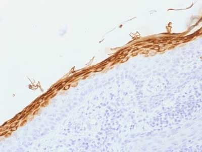 Immunohistochemistry (Formalin/PFA-fixed paraffin-embedded sections) - Anti-Filaggrin antibody [FLG/1562] (AB218397), expandable thumbnail