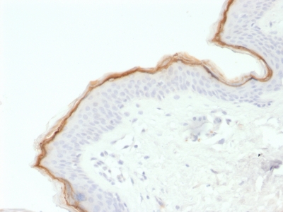 Immunohistochemistry (Formalin/PFA-fixed paraffin-embedded sections) - Anti-Filaggrin antibody [FLG/1563] (AB237996), expandable thumbnail