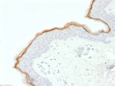 Immunohistochemistry (Formalin/PFA-fixed paraffin-embedded sections) - Anti-Filaggrin antibody [FLG/1563] (AB237996)