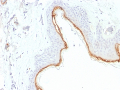 Immunohistochemistry (Formalin/PFA-fixed paraffin-embedded sections) - Anti-Filaggrin antibody [FLG/1945] - BSA and Azide free (AB237840), expandable thumbnail