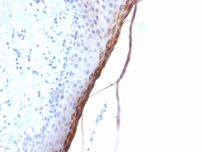 Immunohistochemistry (Formalin/PFA-fixed paraffin-embedded sections) - Anti-Filaggrin antibody [FLG/1957R] (AB234406), expandable thumbnail