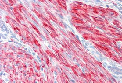 Immunohistochemistry (Formalin/PFA-fixed paraffin-embedded sections) - Anti-Filamin A antibody (AB189183), expandable thumbnail