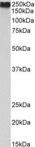 Western blot - Anti-Filamin A antibody (AB190300)