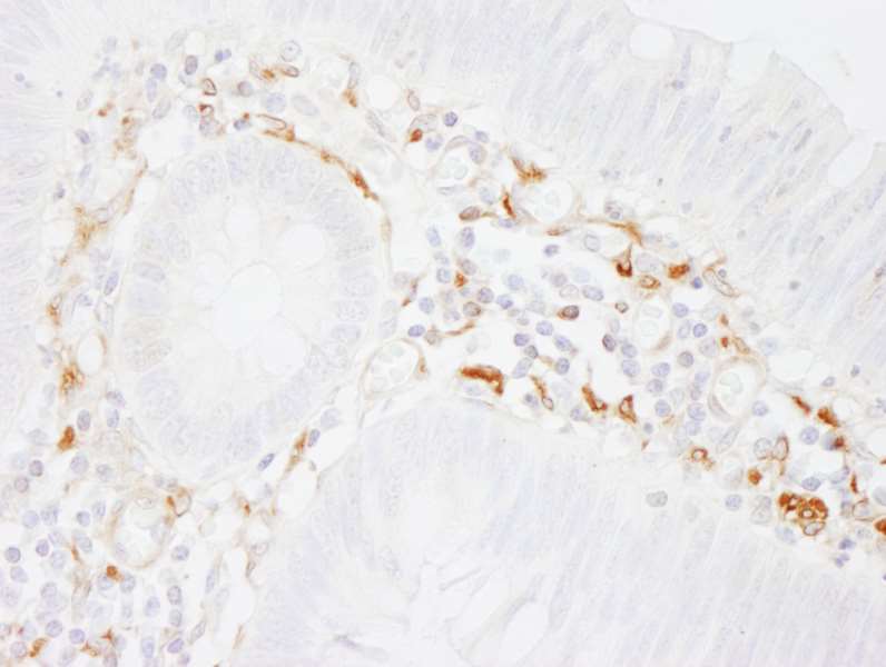 Immunohistochemistry (Formalin/PFA-fixed paraffin-embedded sections) - Anti-Filamin A antibody (AB264184)