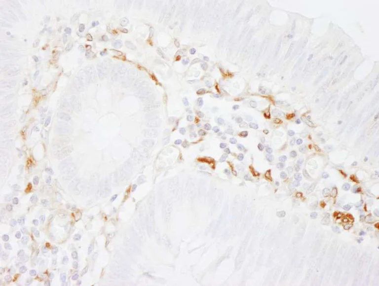 Immunohistochemistry (Formalin/PFA-fixed paraffin-embedded sections) - Anti-Filamin A antibody (AB264184)