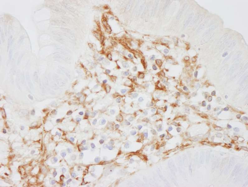 Immunohistochemistry (Formalin/PFA-fixed paraffin-embedded sections) - Anti-Filamin A antibody (AB264185)