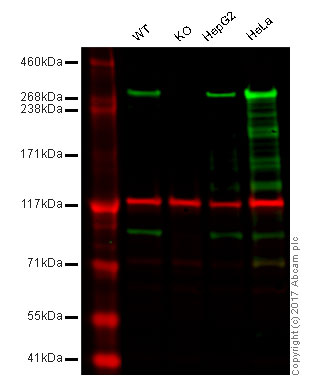 Western blot - Anti-Filamin A antibody [EP2405Y] (AB76289), expandable thumbnail