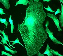 Immunocytochemistry/ Immunofluorescence - Anti-Filamin A antibody [EP2405Y] - BSA and Azide free (AB239881), expandable thumbnail