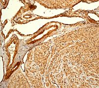 Immunohistochemistry (Formalin/PFA-fixed paraffin-embedded sections) - Anti-Filamin A antibody [EP2405Y] - BSA and Azide free (AB239881), expandable thumbnail