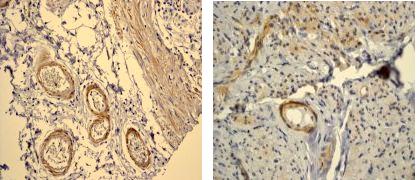 Immunohistochemistry (Formalin/PFA-fixed paraffin-embedded sections) - Anti-Filamin A (phospho S1458) antibody [EP2309Y] (AB68424)