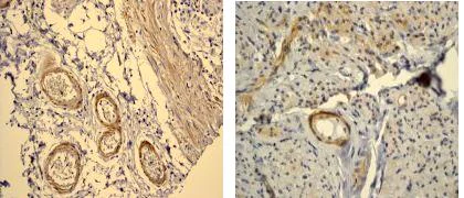 Immunohistochemistry (Formalin/PFA-fixed paraffin-embedded sections) - Anti-Filamin A (phospho S1458) antibody [EP2309Y] (AB68424)
