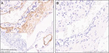 Immunohistochemistry (Formalin/PFA-fixed paraffin-embedded sections) - Anti-Filamin A (phospho S1458) antibody [EP2309Y] (AB68424)