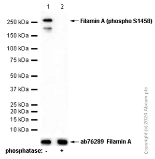 Western blot - Anti-Filamin A (phospho S1458) antibody [EP2309Y] - BSA and Azide free (AB284712)