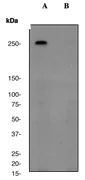 Western blot - Anti-Filamin A (phospho S1458) antibody [EP2309Y] - BSA and Azide free (AB284712)