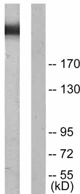 Western blot - Anti-Filamin A (phospho S2152) antibody (AB51229), expandable thumbnail
