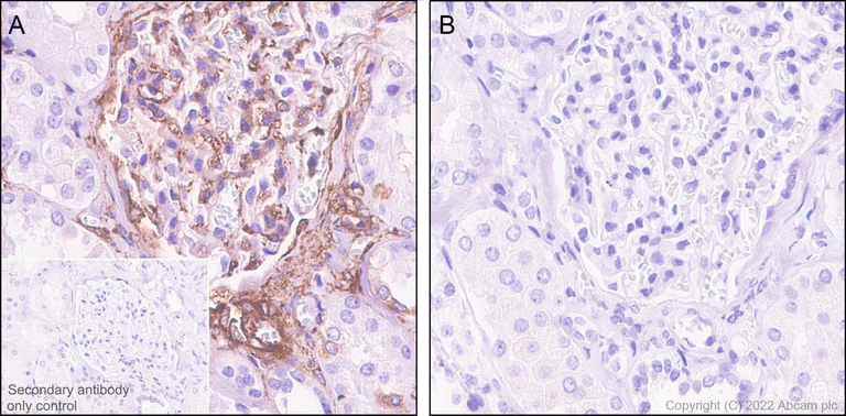 Immunohistochemistry (Formalin/PFA-fixed paraffin-embedded sections) - Anti-Filamin A (phospho S2152) + Filamin B (phospho S2107) antibody [EP2310AY] - BSA and Azide free (AB284727)