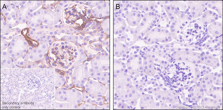 Immunohistochemistry (Formalin/PFA-fixed paraffin-embedded sections) - Anti-Filamin A (phospho S2152) + Filamin B (phospho S2107) antibody [EP2310AY] - BSA and Azide free (AB284727)