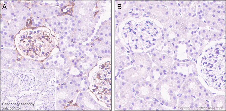 Immunohistochemistry (Formalin/PFA-fixed paraffin-embedded sections) - Anti-Filamin A (phospho S2152) + Filamin B (phospho S2107) antibody [EP2310AY] - BSA and Azide free (AB284727)