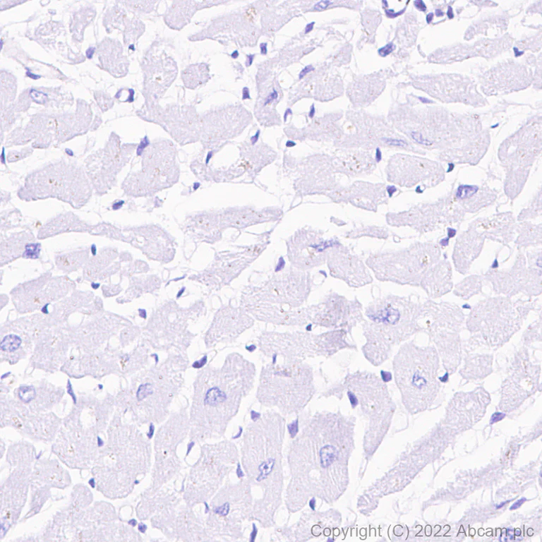 Immunohistochemistry (Formalin/PFA-fixed paraffin-embedded sections) - Anti-Filamin A (phospho S2152) + Filamin B (phospho S2107) antibody [EP2310AY] - BSA and Azide free (AB284727)