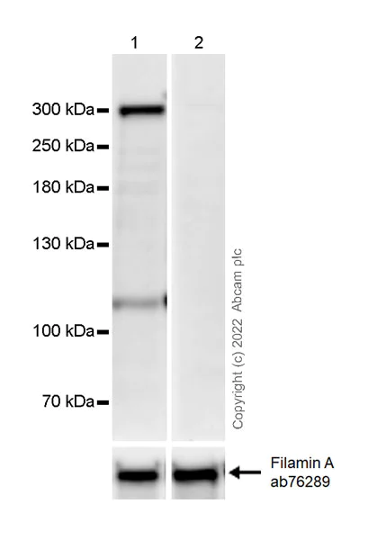 Western blot - Anti-Filamin A (phospho S2152) + Filamin B (phospho S2107) antibody [EP2310AY] - BSA and Azide free (AB284727)