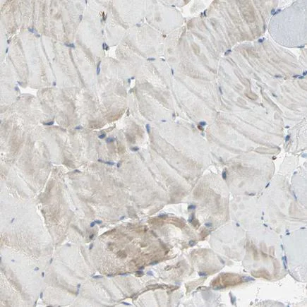 Immunohistochemistry (Formalin/PFA-fixed paraffin-embedded sections) - Anti-Filamin B antibody (AB224334)