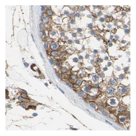 Immunohistochemistry (Formalin/PFA-fixed paraffin-embedded sections) - Anti-Filamin B antibody (AB224334)