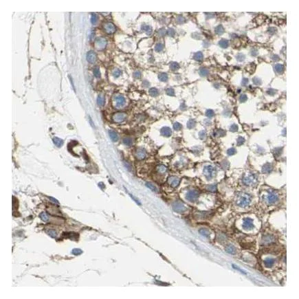 Immunohistochemistry (Formalin/PFA-fixed paraffin-embedded sections) - Anti-Filamin B antibody (AB224334)