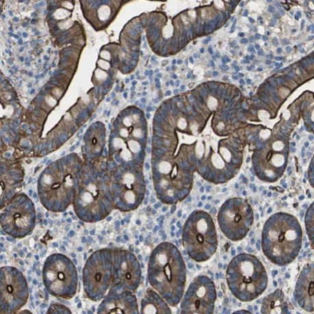 Immunohistochemistry (Formalin/PFA-fixed paraffin-embedded sections) - Anti-Filamin B antibody (AB224334)