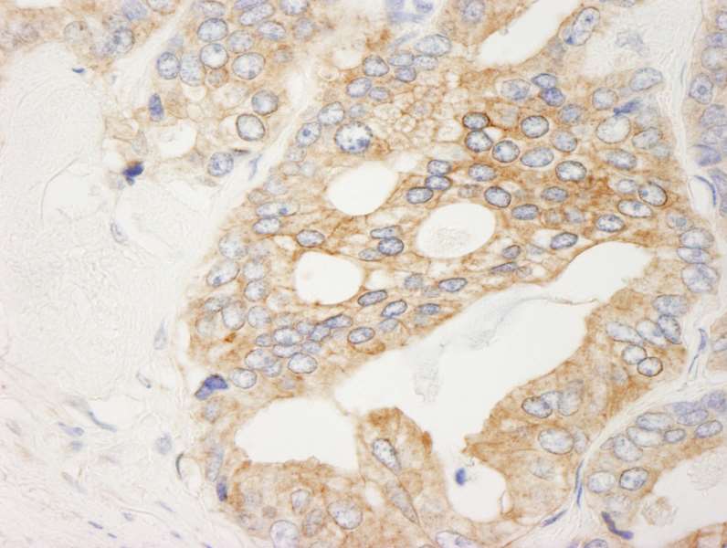 Immunohistochemistry (Formalin/PFA-fixed paraffin-embedded sections) - Anti-Filamin B antibody (AB264227)