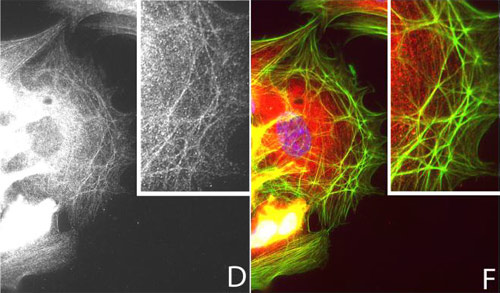 Immunocytochemistry/ Immunofluorescence - Anti-Filamin B antibody (AB97457)