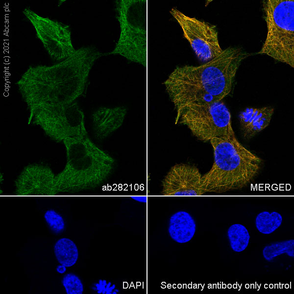 Immunocytochemistry/ Immunofluorescence - Anti-Filamin B antibody [EPR24525-3] (AB282106), expandable thumbnail