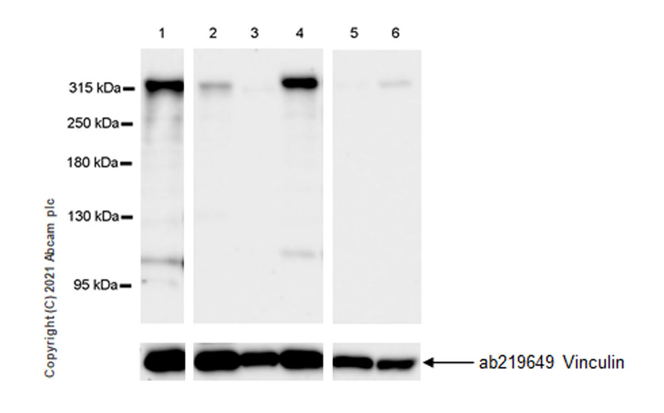 Western blot - Anti-Filamin B antibody [EPR24525-3] (ab282106), expandable thumbnail
