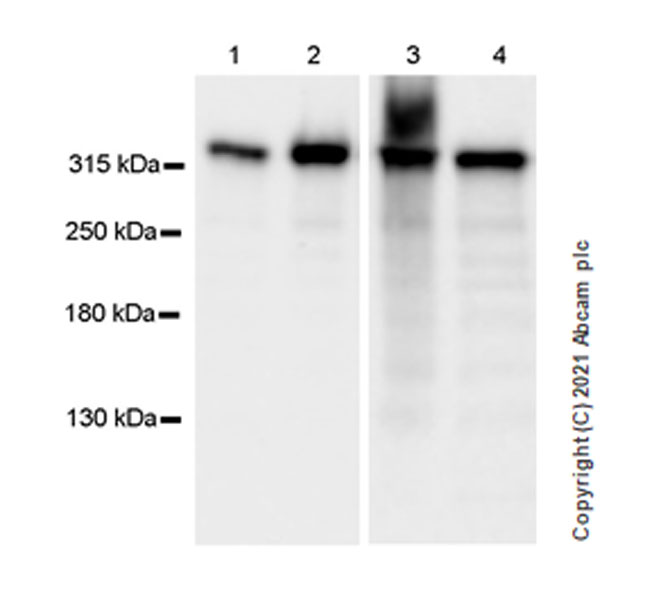 Western blot - Anti-Filamin B antibody [EPR24525-3] (AB282106), expandable thumbnail