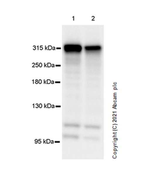 Western blot - Anti-Filamin B antibody [EPR24525-3] (ab282106), expandable thumbnail