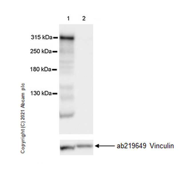 Western blot - Anti-Filamin B antibody [EPR24525-3] (ab282106), expandable thumbnail