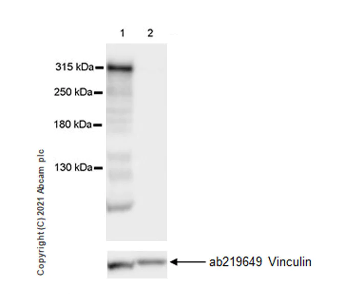 Western blot - Anti-Filamin B antibody [EPR24525-3] (AB282106)