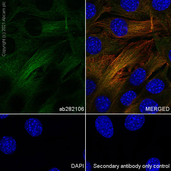 Immunocytochemistry/ Immunofluorescence - Anti-Filamin B antibody [EPR24525-3] - BSA and Azide free (AB282122)