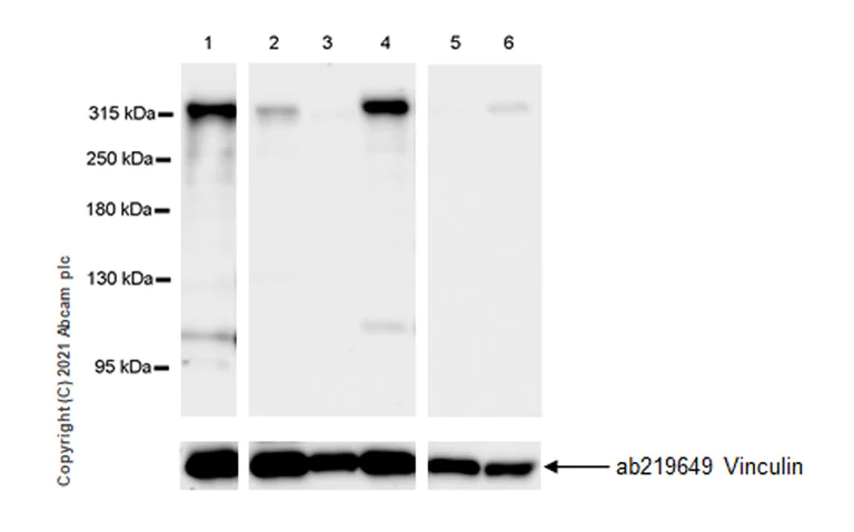 Western blot - Anti-Filamin B antibody [EPR24525-3] - BSA and Azide free (AB282122)