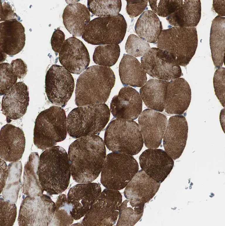 Immunohistochemistry (Formalin/PFA-fixed paraffin-embedded sections) - Anti-Filamin C antibody (AB244284)