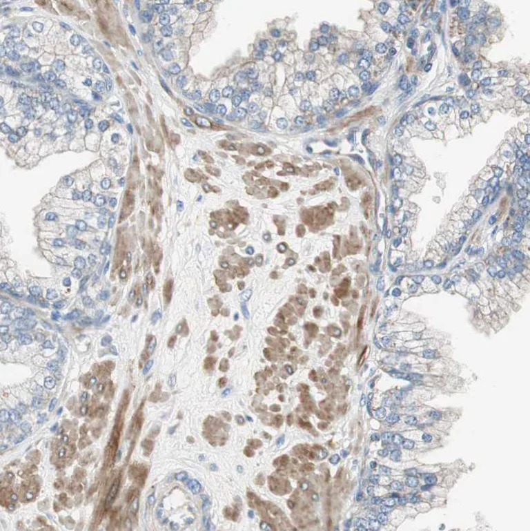 Immunohistochemistry (Formalin/PFA-fixed paraffin-embedded sections) - Anti-Filamin C antibody (AB244284)