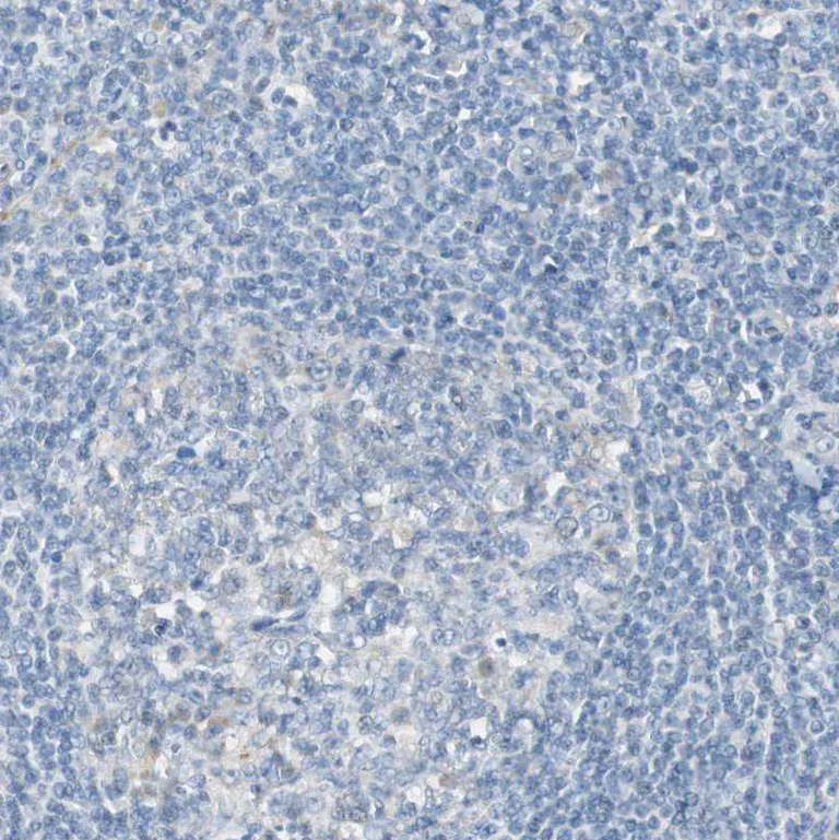 Immunohistochemistry (Formalin/PFA-fixed paraffin-embedded sections) - Anti-Filamin C antibody (AB244284)