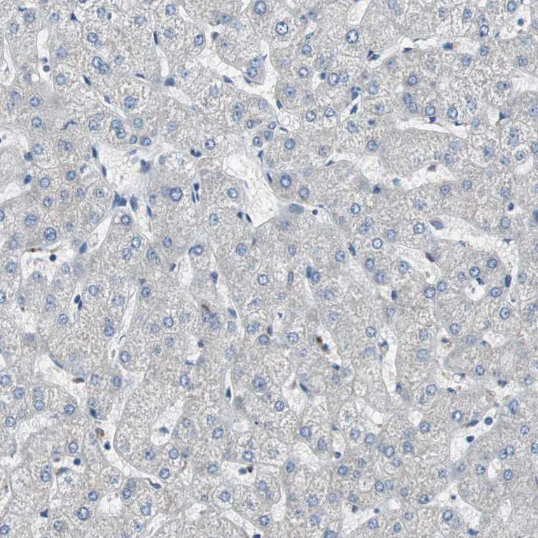 Immunohistochemistry (Formalin/PFA-fixed paraffin-embedded sections) - Anti-Filamin C antibody (AB244284)