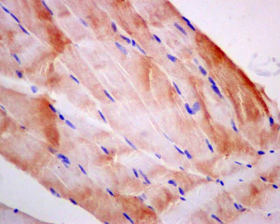 Immunohistochemistry (Formalin/PFA-fixed paraffin-embedded sections) - Anti-Filamin C antibody [EPR14498(B)] (AB180941)