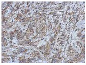 Immunohistochemistry (Formalin/PFA-fixed paraffin-embedded sections) - Anti-Filensin antibody (AB126235)