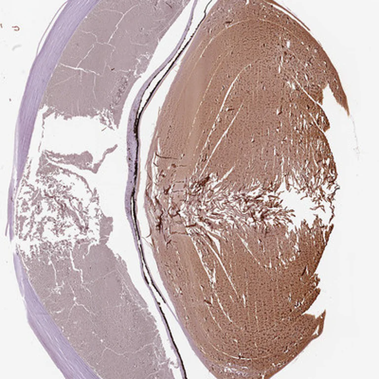 Immunohistochemistry (Formalin/PFA-fixed paraffin-embedded sections) - Anti-Filensin antibody (AB251869)