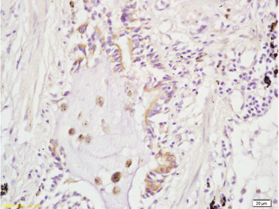 Immunohistochemistry (Formalin/PFA-fixed paraffin-embedded sections) - Anti-FILGAP antibody (AB203874)