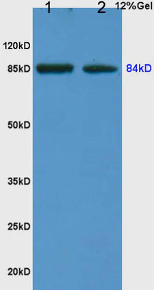 Western blot - Anti-FILGAP antibody (AB203874)